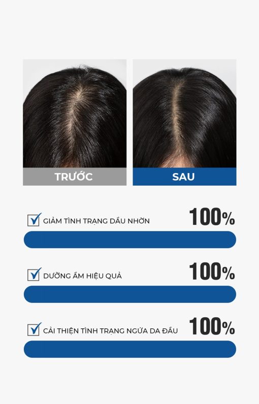 Dầu gội Dashu Daily Anti-Hair Loss Scalp Shampoo Hàn Quốc