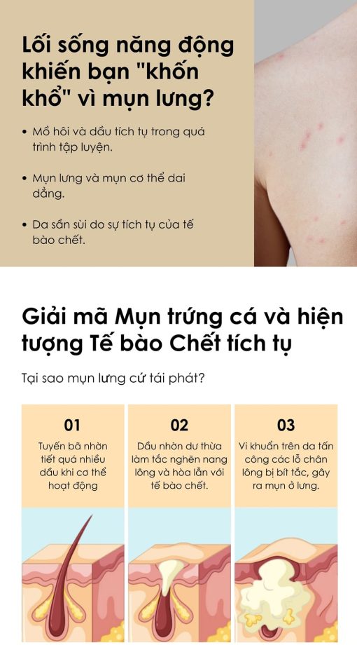 Sữa tắm Apestomen Exfoliating & Anti-Acne từ Singapore